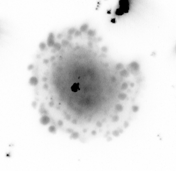 Live imaging of a cell expressing Caveolin-1-GFP