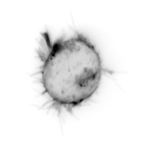 Live-cell imaging of a cancer cell with membrane protrusions