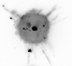Live-cell imaging of a cancer cell