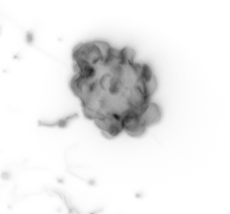 Live-cell imaging of a cancer cell